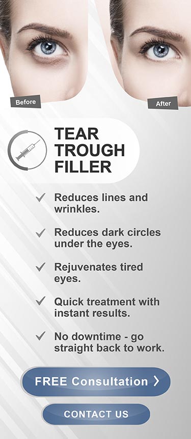 tear trough filler