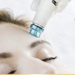 HydraFacial